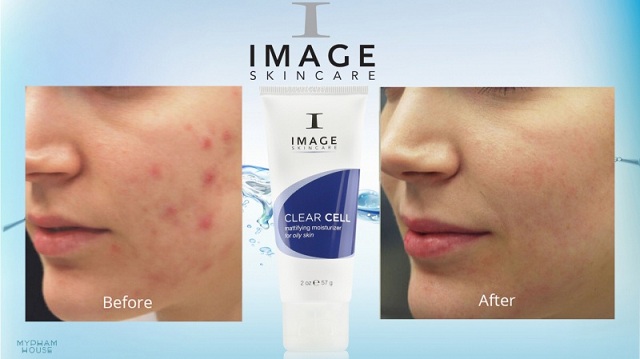 Kem trị mụn cho nam Image Clear Cell Mattifying Moisturizer For Oily Skin