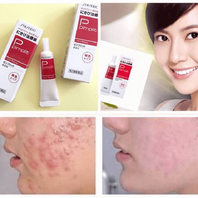 Công dụng chính của kem trị mụn Shiseido Pimplit