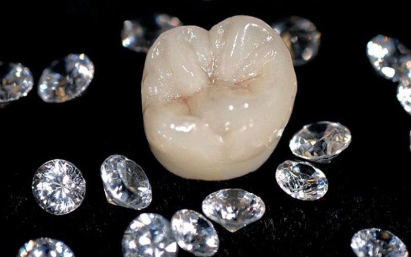 Răng sứ kim cương được cấu tạo từ 100% sứ nguyên chất