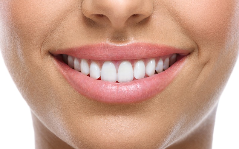 Răng sứ Diamond thích hợp phục hình ở tất cả các vị trí răng