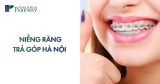 Top +6 Địa Chỉ Niềng Răng Trả Góp Hà Nội Uy Tín & Giá Tốt Nhất