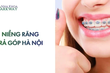 Top +6 Địa Chỉ Niềng Răng Trả Góp Hà Nội Uy Tín & Giá Tốt Nhất